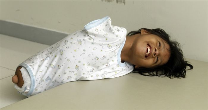 Девочка из Перу, родившаяся без конечностей