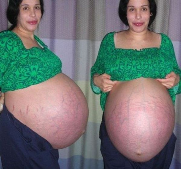 Она знает, как сбросить вес после родов