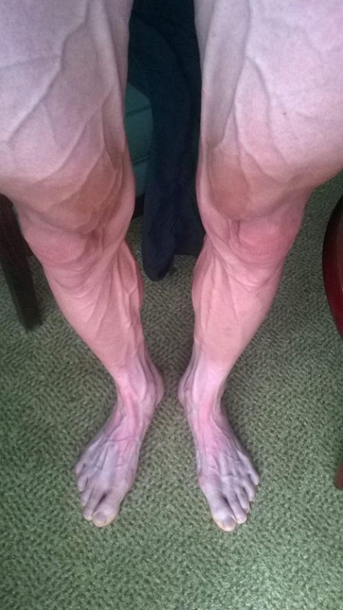 Ноги велогонщика после продолжительной гонки