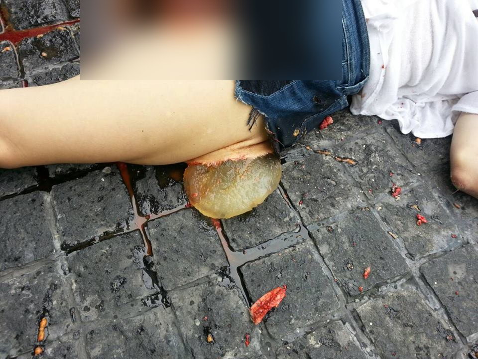Молодая девушка выпала из оконного проема многоэтажного здания