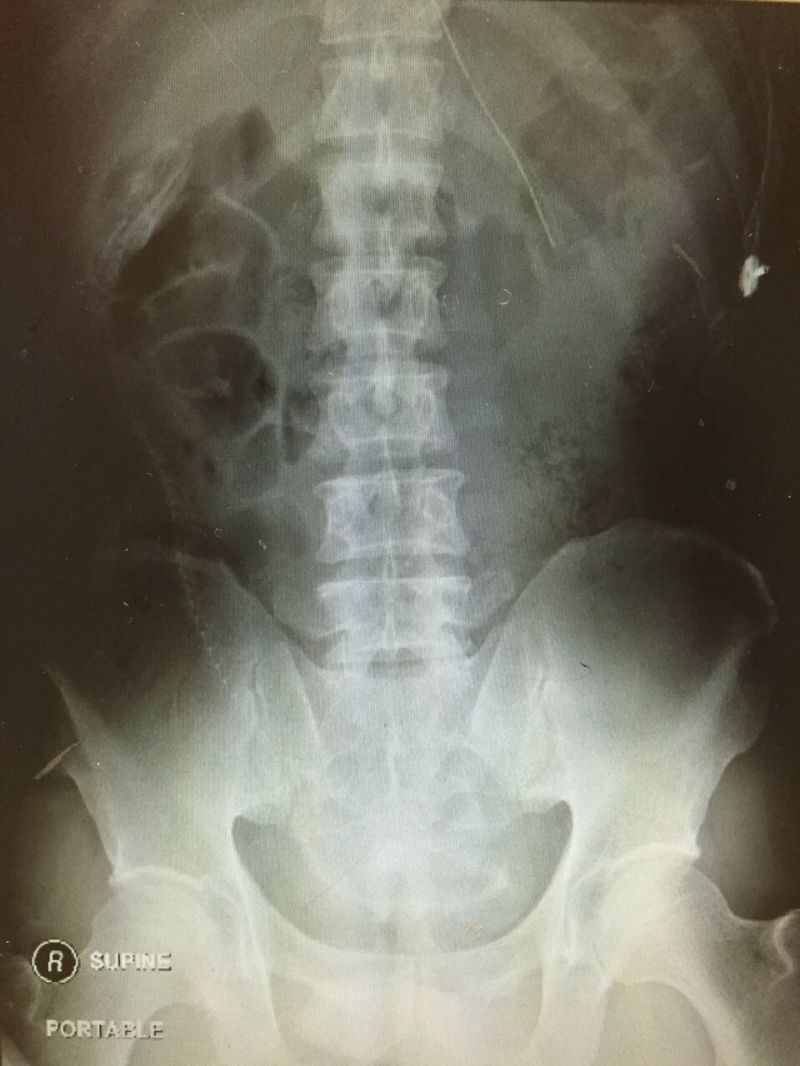 Разгляди на рентгеновском снимке позвоночник угря