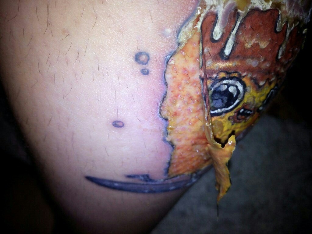 Как выглядит аллергия на краску для татуировки