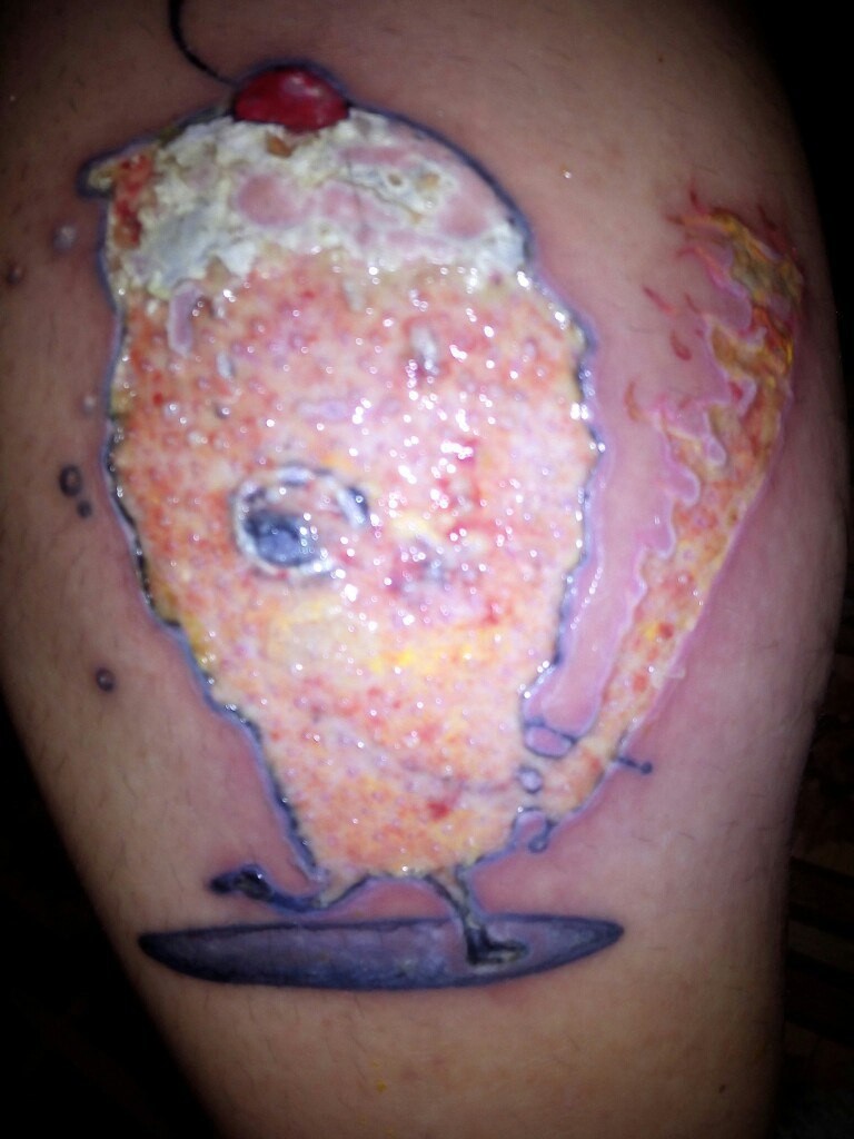 Как выглядит аллергия на краску для татуировки