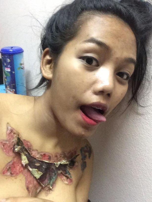 Девушка неудачно удалила татуировку