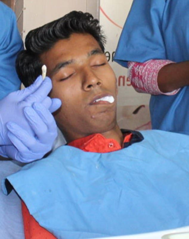 Индийский студент вырастил во рту самый длинный в мире зуб