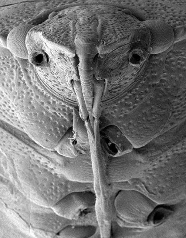 Микробы под ногтями под микроскопом фото