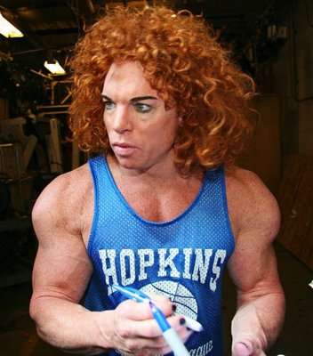 Scott Carrot Top Thompson