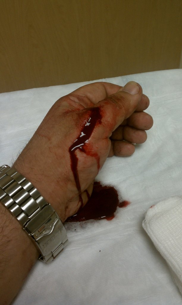Доктор, я привез вам свою раненую руку