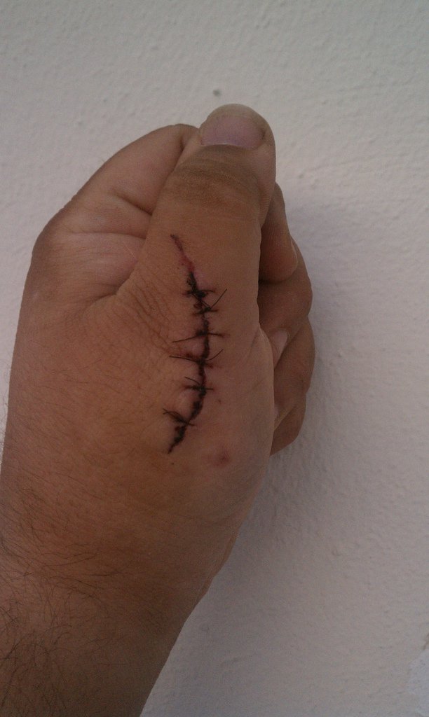 Доктор, я привез вам свою раненую руку