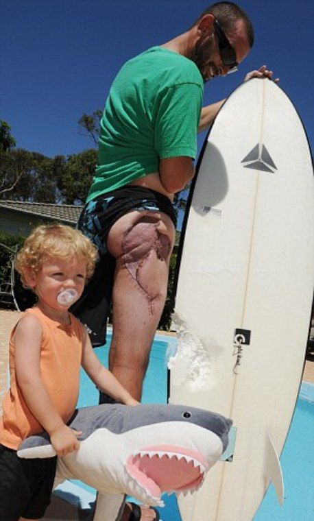 Австралийский серфер выжил после нападения акулы