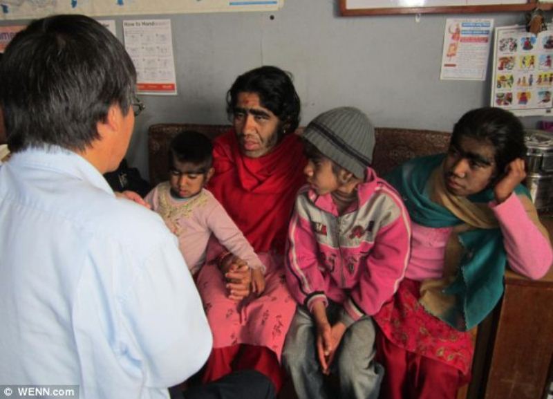 Семья из Непала с редкой болезнью