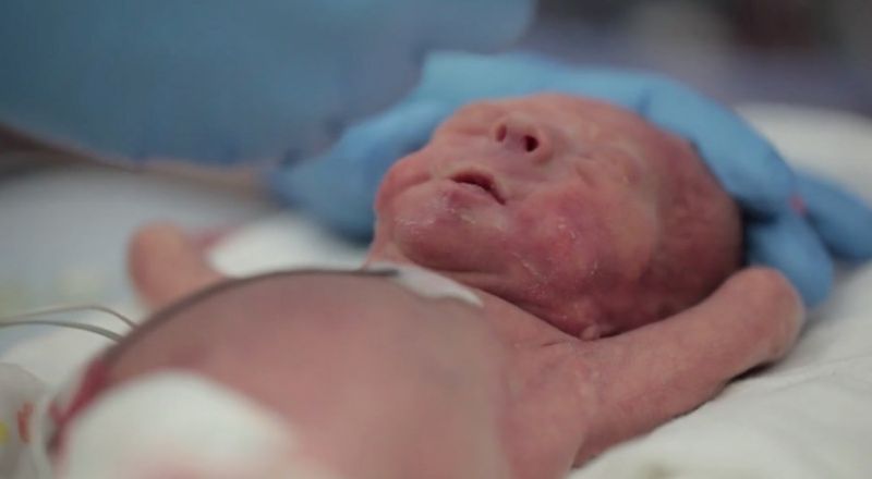 Первый год жизни одного из самых маленьких младенцев на планете