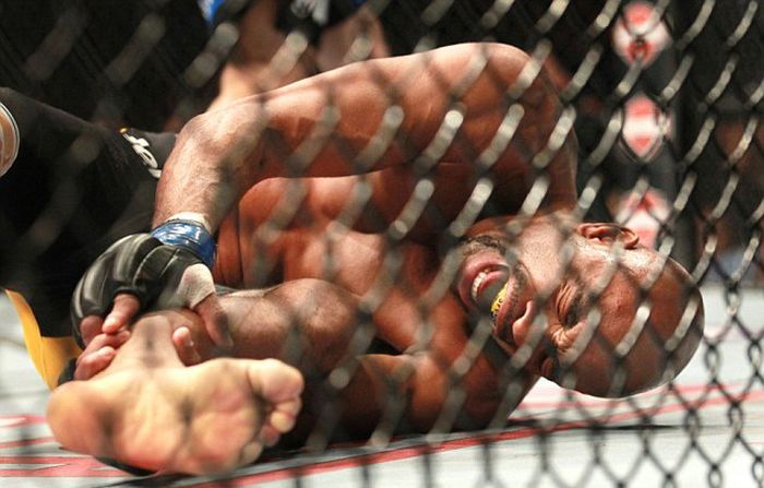 Бойцы MMA бьют так сильно, что порой ломают ноги
