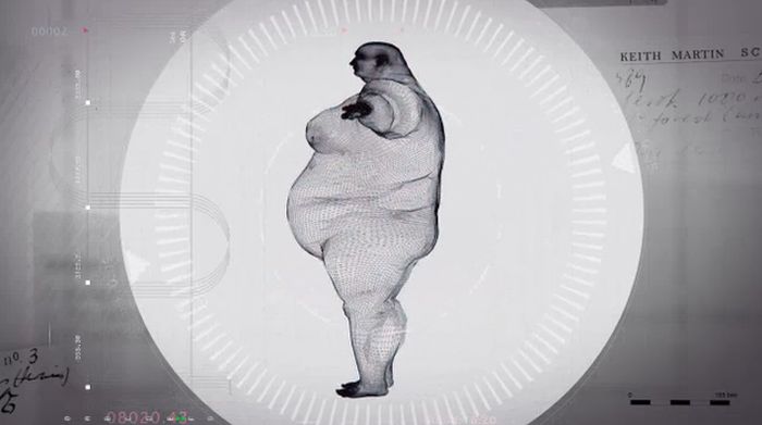 Рентгеновский снимок тела 400-килограммового мужчины