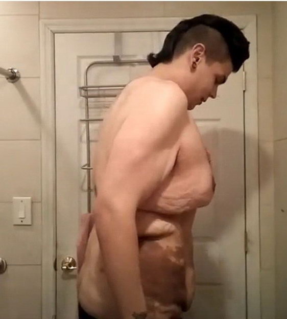 Как выглядит тело похудевшего человека