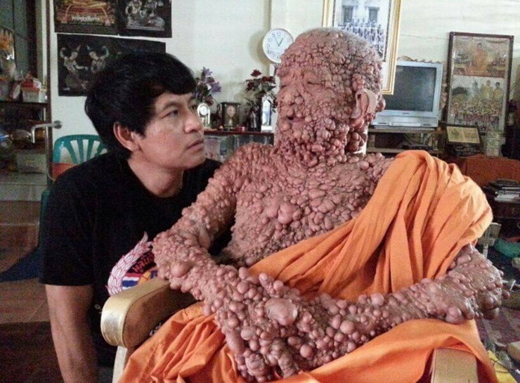 Тайланд. Буддийский монах чем-то захворал