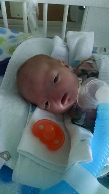 Уникальный младенец, родившийся без носа