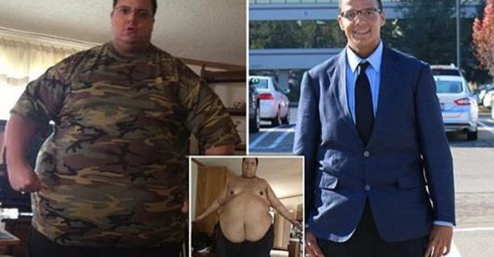 Американец похудел на 181 кг и столкнулся с проблемой лишней кожи