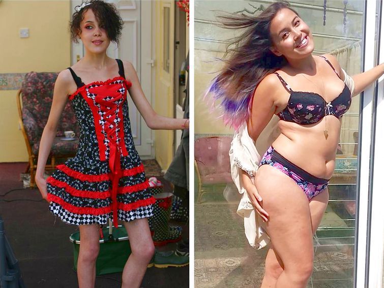 Результат превращения девушки из анорексички в толстушку