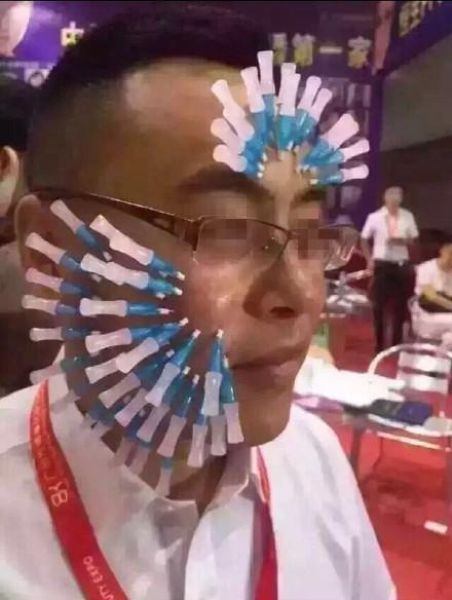 Китайцам очень понравилось тыкать себе в лицо иголки