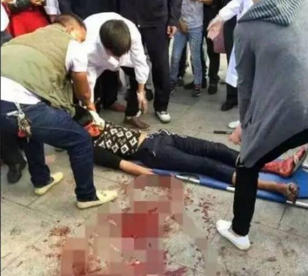 Китаец выжил после удара ножом в голову