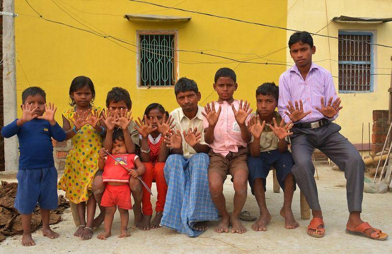 Индийская семья из 25 человек, у которых по 12 пальцев на руках и ногах