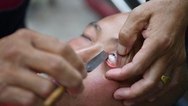 Престарелый китаец чистит глаза всем желающим опасной бритвой