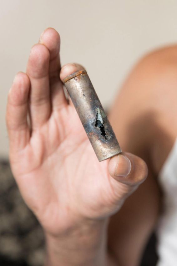 О вреде курения: последствия взрыва электронной сигареты в кармане