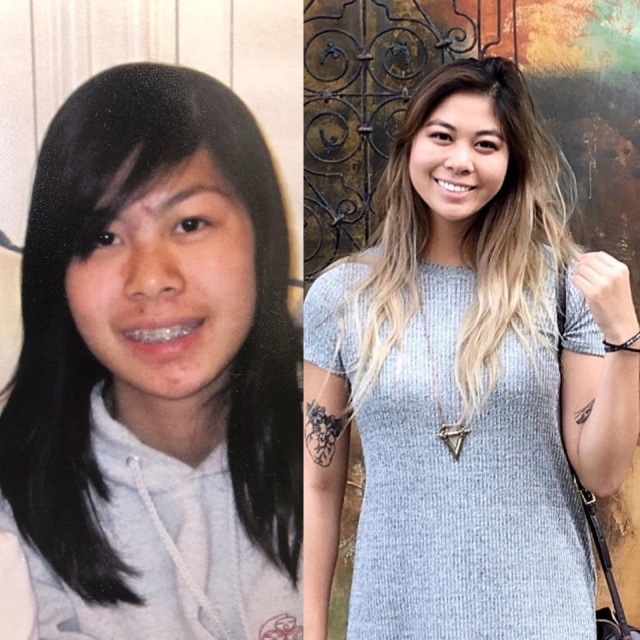До и после: в подростковом возрасте и спустя несколько лет