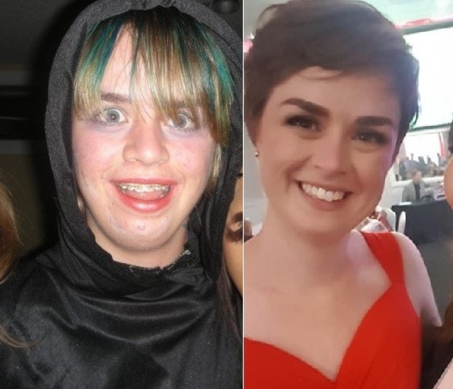 До и после: в подростковом возрасте и спустя несколько лет