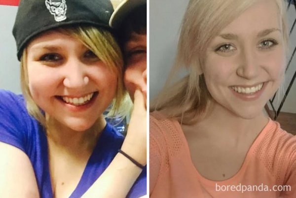До и после: как изменилась внешность девушек, бросивших пить
