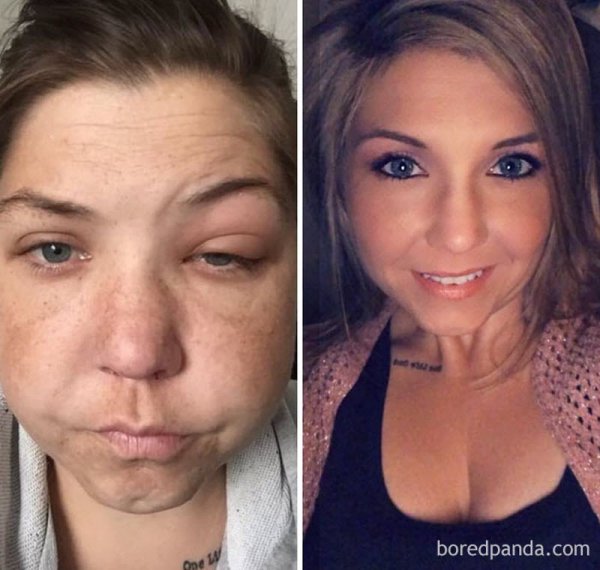 До и после: как изменилась внешность девушек, бросивших пить