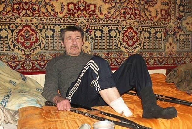 Украинец отрезал себе ступню из-за гангрены, и его выброшенная конечность подняла на уши полицию