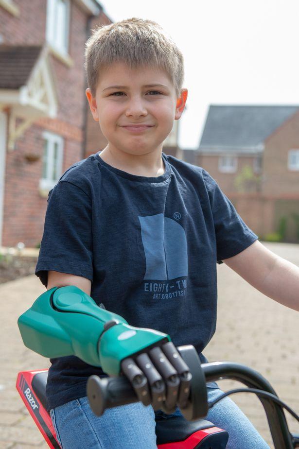 8-летний мальчик стал самым юным обладателем бионической руки Всячина