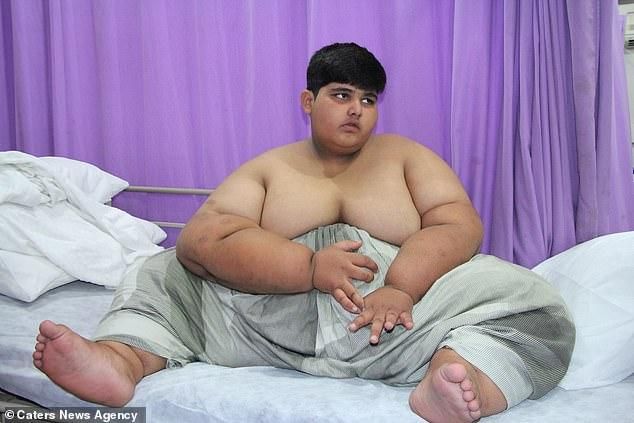 10-летний пакистанец весит почти 200 килограммов