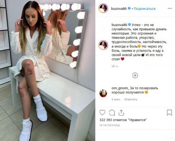 Трудный путь к успеху: Ольга Бузова опубликовала фото с разбитыми коленями