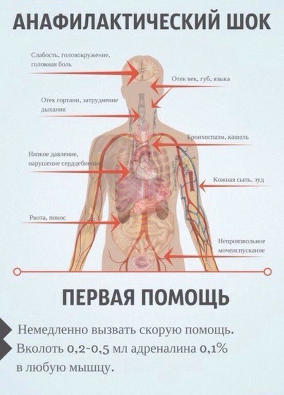 25 шпаргалок, которые могут спасти жизнь когда, могут, помнить, любой, произойти, ситуации, потому что, побежден, будет, вирус, тогда, всегда, жизнь, замер, чьюто, спасти, которые, вещах, элементарных, забывают