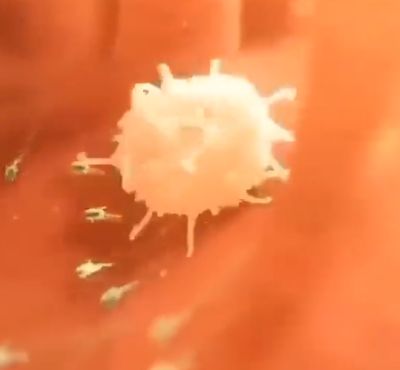 Это видео показывает, как иммунная клетка преследует бактерии и уничтожает их