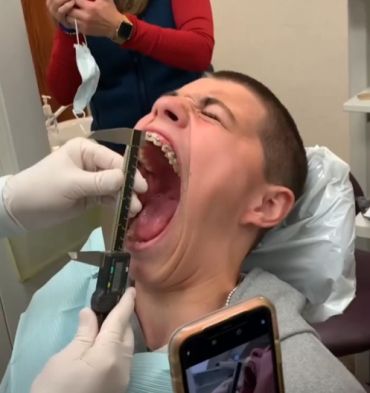 Мировой рекорд по самому широкому раскрытию рта среди мужчин