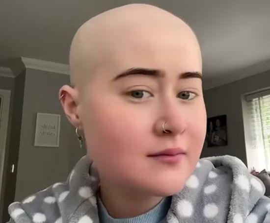 Девушка отращивает волосы после химиотерапии⁠⁠