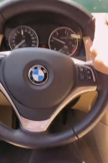 У кого бывает BMW головного мозга?