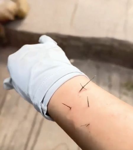 Обезьяна помогла смотрителю зоопарка избавиться от колючек