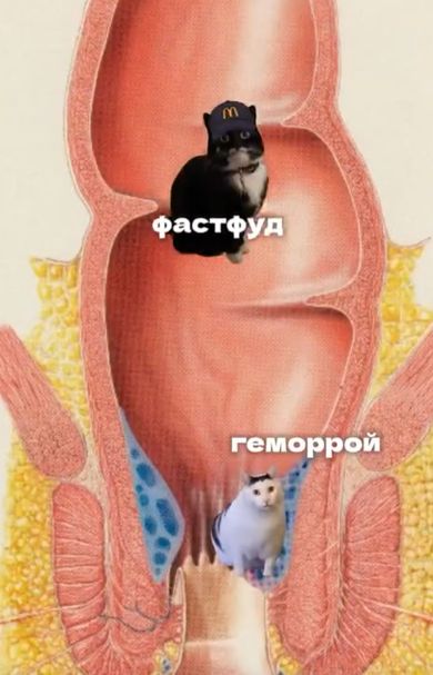 Московский центр проктологии создал мемную рекламу операции по удалению геморроя