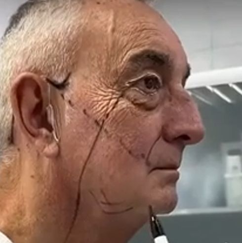 Как вы относитесь к таким операциям у мужчин?
