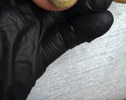 Босс вросших ногтей