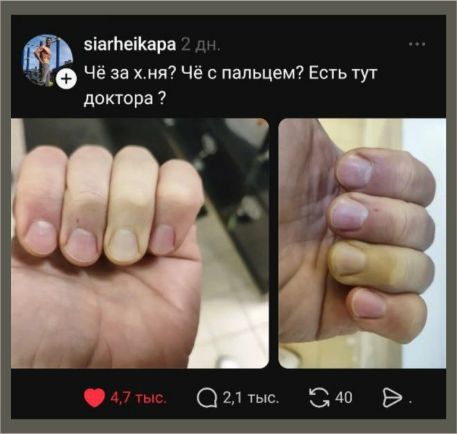 Есть тут доктора? Что с пальцем?