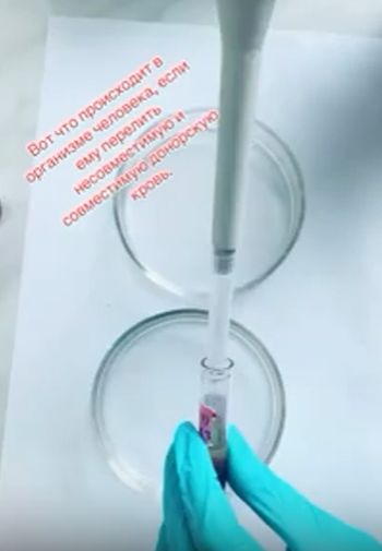 Познавательное видео про переливание крови