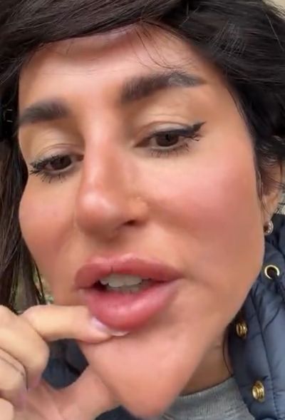 Жертва пластики