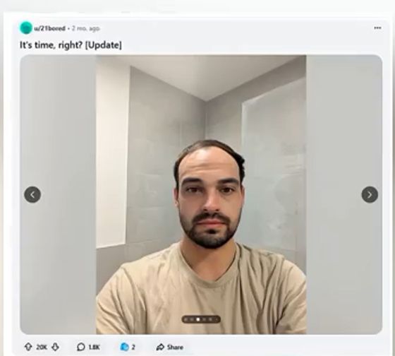 Про сайт лысых мужиков