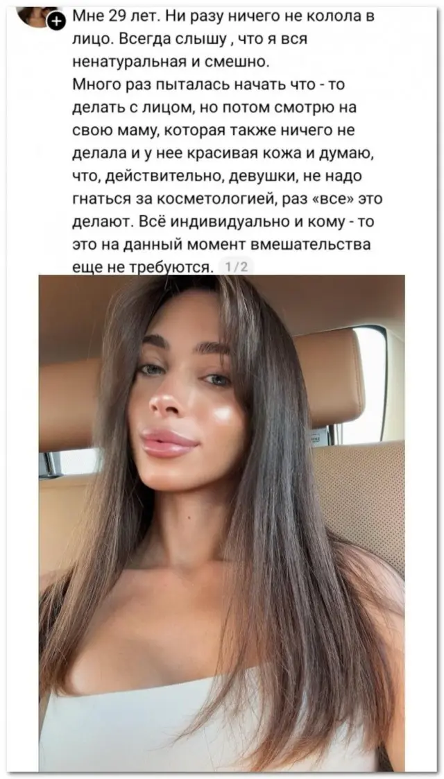 «Ни разу ничего не колола в лицо»